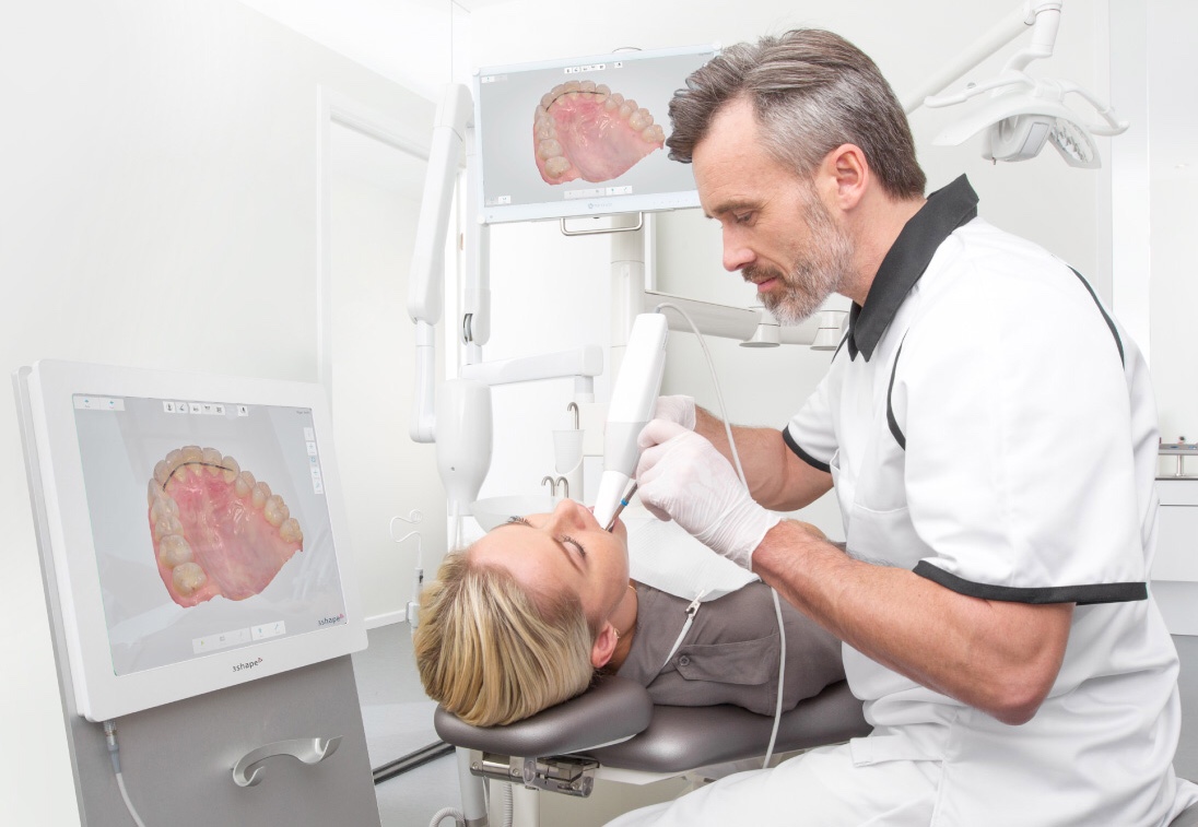 Может пора купить внутриротовой сканнер?