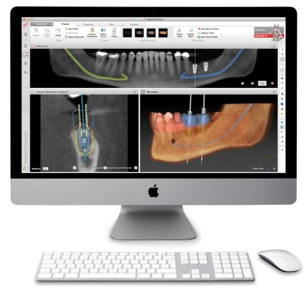 Программное обеспечение NobelClinician работает на базе операционных систем Mac OS® X, Windows® 7 и Windows® 8 с единым оформлением интерфейса, форматом файлов и набором функций.